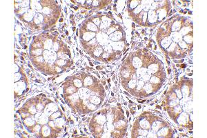 Immunohistochemistry (IHC) image for anti-Bone Marrow Stromal Cell Antigen 2 (BST2) (N-Term) antibody (ABIN1031283) (BST2 antibody  (N-Term))
