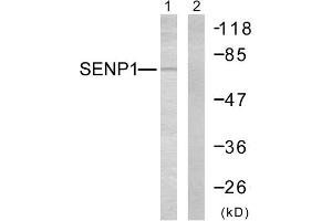 Western Blotting (WB) image for anti-SUMO1/sentrin Specific Peptidase 1 (SENP1) (N-Term) antibody (ABIN1848841) (SENP1 antibody  (N-Term))