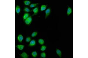 Immunofluorescence staining of A549 cells with ABIN7152326 at 1:200, counter-stained with DAPI. (FAM62B antibody  (AA 567-736))