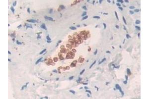 Band 3/AE1 antibody  (AA 35-290)