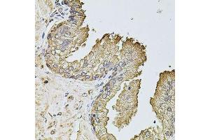 Immunohistochemistry of paraffin-embedded human prostate using PTCD3 antibody. (PTCD3 antibody  (AA 450-689))