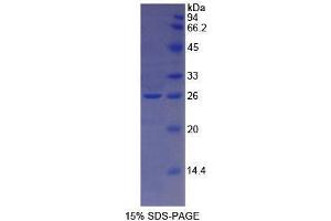 SDS-PAGE analysis of Human TFR2 Protein.