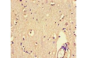 Immunohistochemistry of paraffin-embedded human brain tissue using ABIN7167518 at dilution of 1:100 (PTPRS antibody  (AA 25-128))