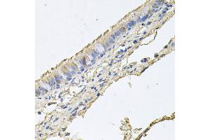 Immunohistochemistry of paraffin-embedded human trachea using EPOR antibody (ABIN5971509) at dilution of 1/100 (40x lens). (EPOR antibody)