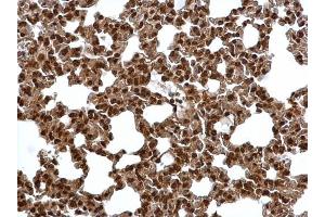 IHC-P Image Proteasome 20S alpha 6 antibody detects Proteasome 20S alpha 6 protein at cytosol and nucleus on mouse lung by immunohistochemical analysis. (PSMA6 antibody  (Center))