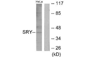Western Blotting (WB) image for anti-Sex Determining Region Y (SRY) (Internal Region) antibody (ABIN1849549) (SRY antibody  (Internal Region))