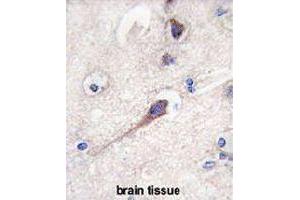 Formalin-fixed and paraffin-embedded human brain tissue reacted with HPCA polyclonal antibody  , which was peroxidase-conjugated to the secondary antibody, followed by DAB staining. (Hippocalcin antibody  (N-Term))