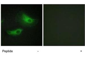 Immunofluorescence analysis of HeLa cells, using ADD2 polyclonal antibody .