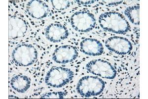 Image no. 4 for anti-Checkpoint Kinase 2 (CHEK2) antibody (ABIN1497498) (CHEK2 antibody)