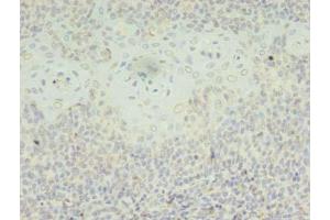 Immunohistochemistry of paraffin-embedded human tonsil tissue using ABIN7169479 at dilution of 1:100 (SH3BGRL antibody  (AA 1-114))