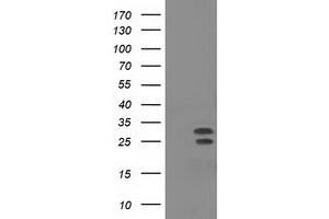 Western Blotting (WB) image for anti-Nonhomologous End-Joining Factor 1 (NHEJ1) antibody (ABIN1499730) (NHEJ1 antibody)