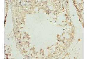 Immunohistochemistry of paraffin-embedded human testis tissue using ABIN7164276 at dilution of 1:100 (PRICKLE2 antibody  (AA 615-844))