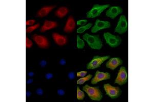 ABIN6265478 and ABIN6279868 staining Hela cells by IF/ICC. (TBC1D2 antibody  (N-Term))