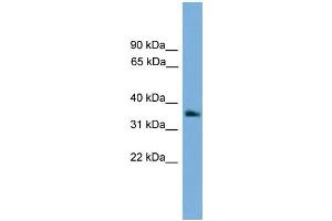 WB Suggested Anti-GNB4 Antibody Titration: 0. (GNB4 antibody  (Middle Region))