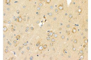 ABIN6262120 and ABIN6273253 at 1/100 staining Rat brain tissue by IHC-P. (GSTM4 antibody  (Internal Region))