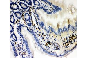 IHC analysis of RUNX3 using anti-RUNX3 antibody (ABIN3043318).