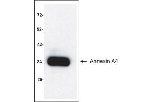 Antigen: Colo 205 cells lysate (Total protein per lane: 15 µg)  Primary Antibody: Anti-ANXA4 monoclonal (PA351-29. (Annexin IV antibody)
