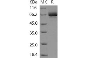 EPH Receptor B1 Protein (EPHB1) (AA 565-984) (GST tag,His tag)