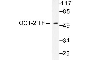 Image no. 1 for anti-POU domain, class 2, transcription factor 2 (POU2F2) antibody (ABIN271754) (Oct-2 antibody)