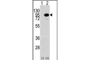 Western blot analysis of ACO2 (arrow) using rabbit polyclonal ACO2 Antibody (Center) (ABIN391809 and ABIN2841660). (ACO2 antibody  (AA 294-325))