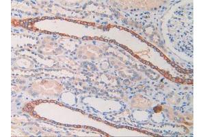 DAB staining on IHC-P; Samples: Human Kidney Tissue. (CYFRA21.1 antibody  (AA 244-400))