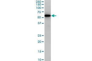 CDK8 monoclonal antibody (M02), clone 6E5. (CDK8 antibody  (AA 375-464))