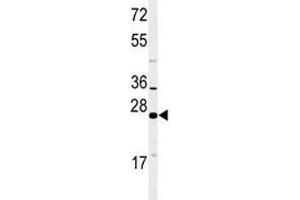 Western blot analysis of RAB27B antibody and NCI-H460 lysate. (RAB27B antibody  (AA 186-215))