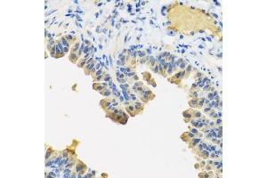 Immunohistochemistry of paraffin-embedded mouse lung using  antibody (ABIN6127432, ABIN6136873, ABIN6136875 and ABIN6223859) at dilution of 1:100 (40x lens). (Angiopoietin 1 antibody  (AA 260-400))
