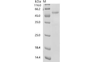(Tris-Glycine gel) Discontinuous SDS-PAGE (reduced) with 5 % enrichment gel and 15 % separation gel.