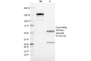 SDS-PAGE Analysis Purified CD1a Mouse Monoclonal Antibody (CB-T6). (CD1a antibody)