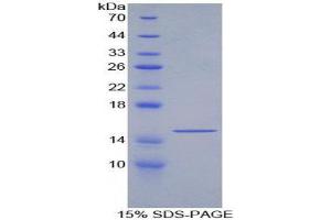 SDS-PAGE (SDS) image for Growth Differentiation Factor 6 (GDF6) (AA 336-455) protein (His tag) (ABIN2121177)