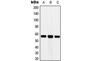 Western blot analysis of Cytochrome P450 3A7 expression in HEK293T (A), Raw264. (CYP3A7 antibody  (Center))