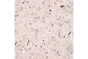 Immunohistochemistry (Paraffin-embedded Sections) (IHC (p)) image for anti-Kinectin 1 (Kinesin Receptor) (KTN1) (AA 1-100) antibody (ABIN6143045)