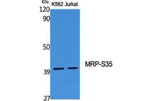 Western Blot (WB) analysis of specific cells using MRP-S35 Polyclonal Antibody. (MRPS35 antibody  (Internal Region))
