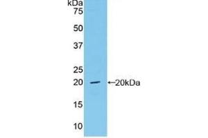 Detection of Recombinant vWF, Mouse using Polyclonal Antibody to Von Willebrand Factor (vWF) (VWF antibody  (AA 1498-1665))