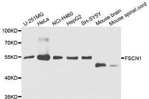Western blot analysis of extracts of various cell lines, using FSCN1 antibody. (Fascin antibody  (AA 394-493))