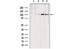 Western blot analysis of extracts from various samples, using NOD2 antibody. (NOD2 antibody  (N-Term))