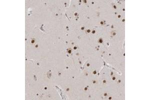 Immunohistochemical staining of human cerebral cortex with CXorf23 polyclonal antibody  shows strong nuclear positivity in neuronal cells. (CXORF23 antibody)