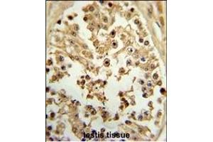 Formalin-fixed and paraffin-embedded human testis tissue reacted with EIF4E Antibody (ABIN650675 and ABIN2838634) , which was peroxidase-conjugated to the secondary antibody, followed by DAB staining. (EIF4E antibody)