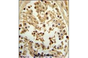 Formalin-fixed and paraffin-embedded human testis tissue reacted with EIF4E Antibody (ABIN650675 and ABIN2838634) , which was peroxidase-conjugated to the secondary antibody, followed by DAB staining. (EIF4E antibody)