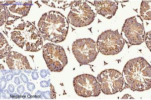 Immunohistochemical analysis of paraffin-embedded mouse testis tissue. (CDX2 antibody)