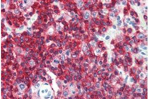Anti-CD45RA antibody IHC staining of human spleen. (CD45RA antibody  (FITC))