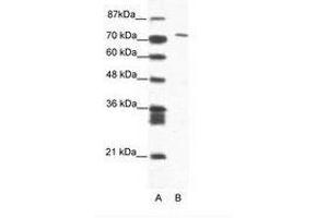 Image no. 1 for anti-Mastermind-Like Domain Containing 1 (MAMLD1) (AA 180-229) antibody (ABIN202873) (MAMLD1 antibody  (AA 180-229))