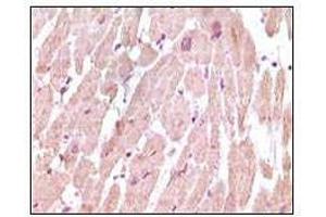 Immunohistochemical analysis of paraffin-embedded human normal cardiac muscle tissue, showing cytoplasmic localization using cTnI antibody with DAB staining. (TNNI3 antibody)