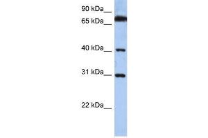 Human HeLa; WB Suggested Anti-DHRSX Antibody Titration: 0. (DHRSX antibody  (C-Term))