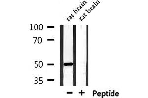 Western blot analysis of extracts from rat brain, using TXNIP Antibody. (TXNIP antibody  (Internal Region))