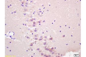 Formalin-fixed and paraffin embedded rat brain labeled with Anti-RASSF1A Polyclonal Antibody, Unconjugated (ABIN673764) at 1:200 followed by conjugation to the secondary antibody and DAB staining. (RASSF1 antibody  (AA 145-260))