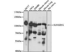 Western blot analysis of extracts of various cell lines, using SUV420H1 antibody (ABIN7270648) at 1:1000 dilution. (SUV420H1 antibody  (AA 100-200))