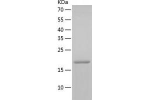 Western Blotting (WB) image for Ras Homolog Gene Family, Member C (RHOC) (AA 1-190) protein (His tag) (ABIN7124787) (RHOC Protein (AA 1-190) (His tag))