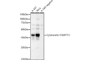 Western blot analysis of extracts of various cell lines, using Cytokeratin 17 (KRT17) antibody (ABIN6130112, ABIN6143023, ABIN6143024 and ABIN6213626) at 1:1298 dilution. (KRT17 antibody  (AA 133-432))